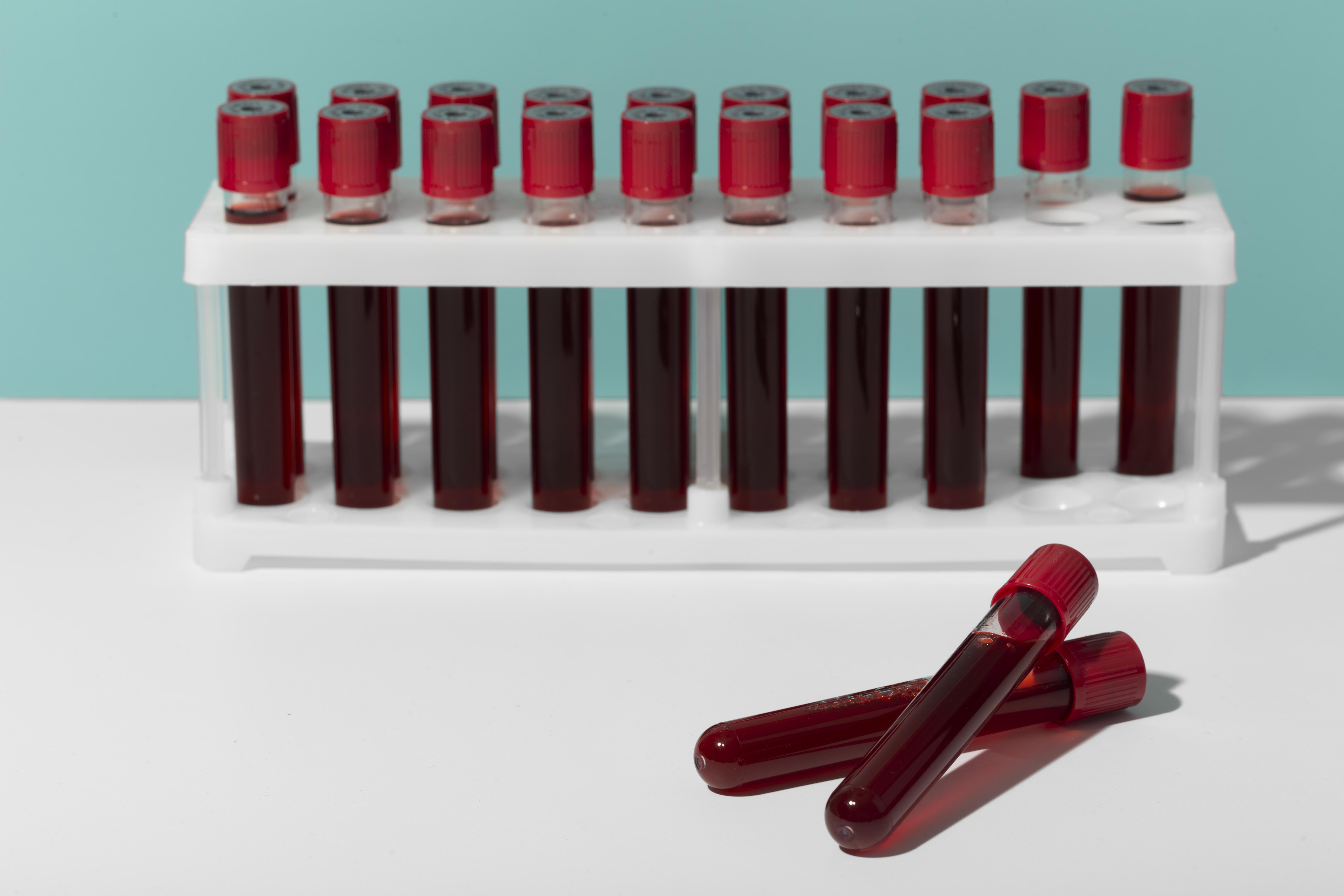 Centres de transfusion